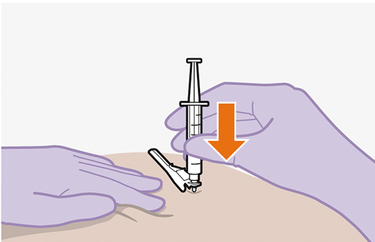Infographic depicting a medical professional inserting a needle into a patient.